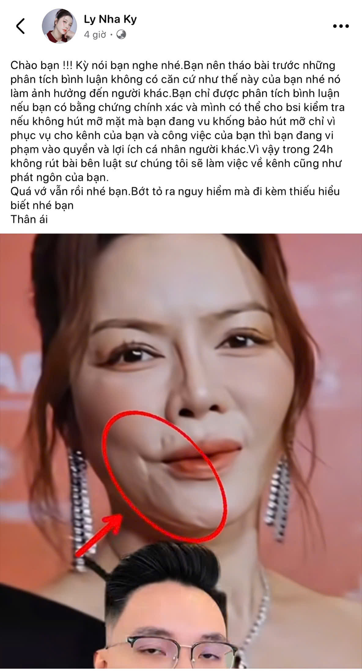 Lý Nhã Kỳ nổi đóa khi bị đồn sửa nát mặt tuyên bố sẽ khởi kiện