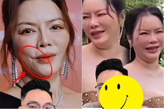 Lý Nhã Kỳ nổi đóa khi bị đồn 'sửa nát mặt', tuyên bố sẽ khởi kiện