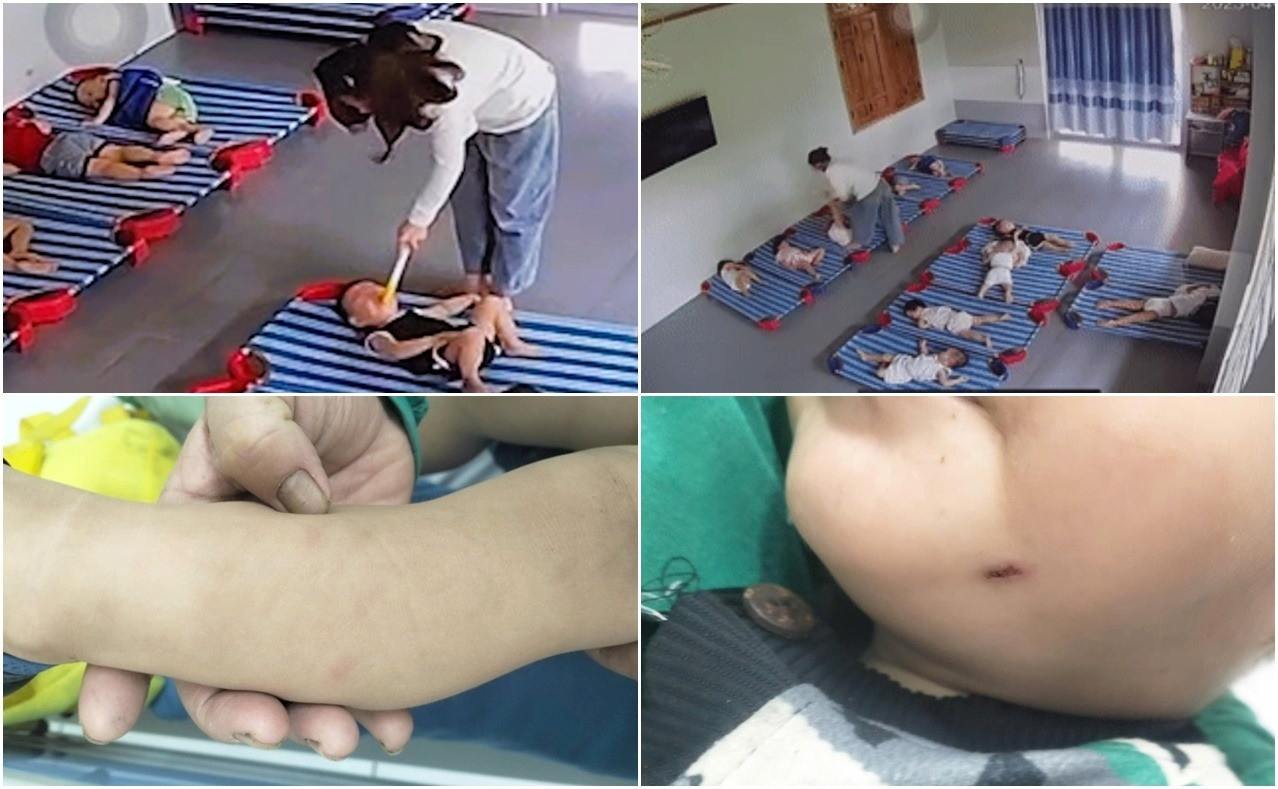 bao hanh tre em 1.jpg