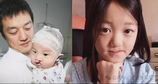 Sự thật sau tin đồn Vương Phi bỏ bê con gái bị hở hàm ếch