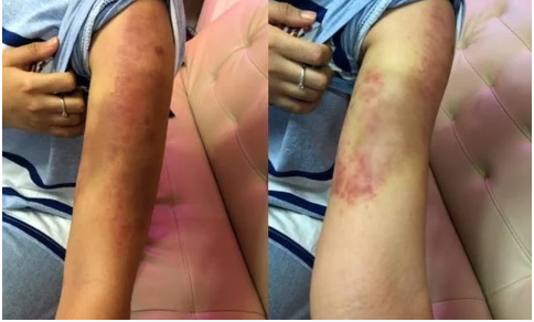 Phương Mỹ Chi uống thuốc, nhào nặn đốt mỡ vì ám ảnh giảm cân - Ảnh 4