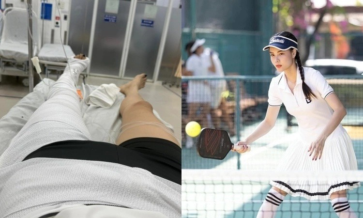Kỳ Hân giải thích lý do gãy xương đùi vẫn ngồi xe lăn chơi pickleball
