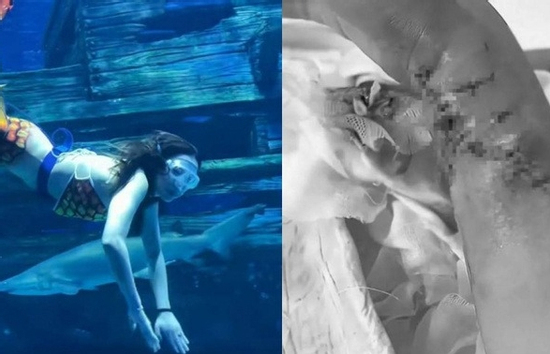 ‘Nàng tiên cá’ bị cá mập cắn tàn phế trong thủy cung