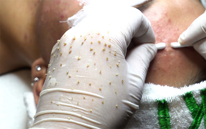 Nhiều người có xu hướng thích xem hình ảnh kinh dị.