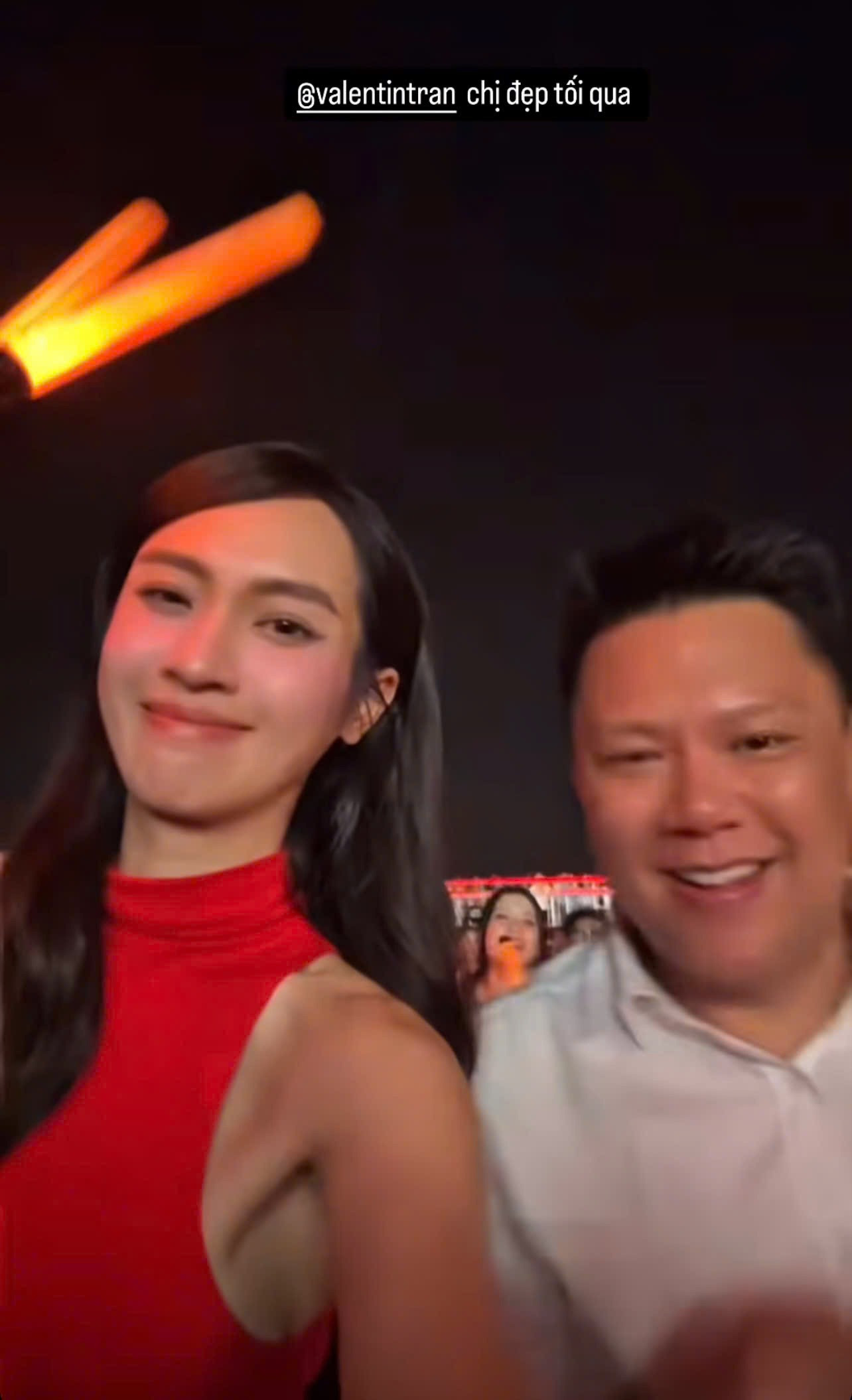 Á hậu Vbiz bị nghi dao kéo sau tin đồn toang với người yêu đồng giới