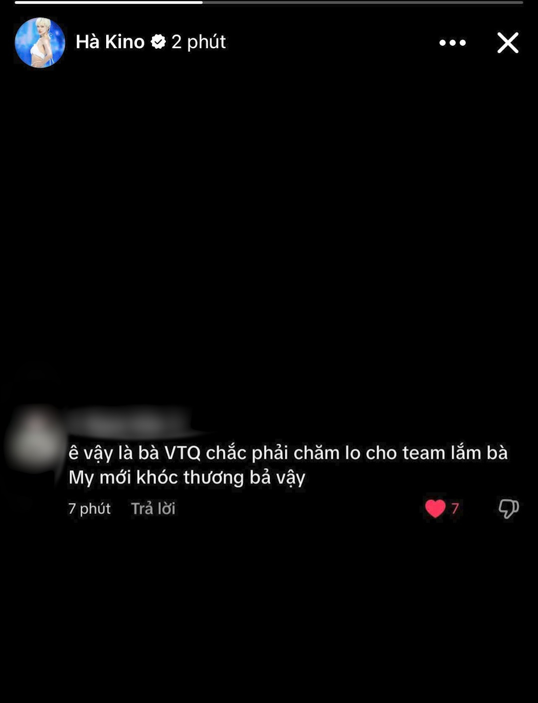 Á hậu Vbiz bị nghi dao kéo sau tin đồn toang với người yêu đồng giới