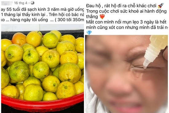 Trào lưu nhỏ 'thần dược' nước chanh vào mắt, bác sĩ cảnh báo bỏng axit