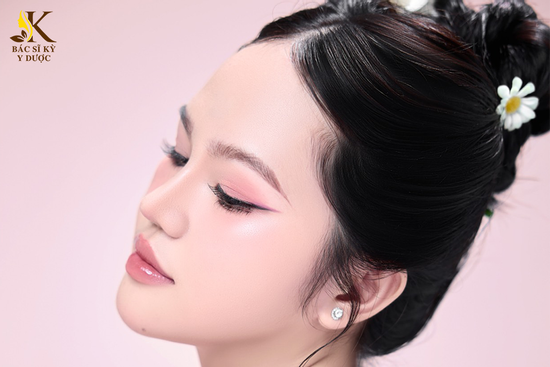 Nâng mũi dáng tự nhiên với phương pháp Aline