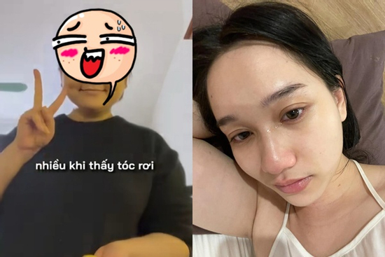 Trúc Anh 'Mắt Biếc' lộ mái tóc rụng tả tơi, xơ xác đến mức nhìn chỉ muốn khóc
