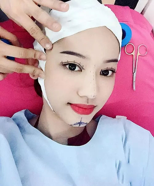 Giật mình diện mạo hiện tại của hot girl Cà Mau Thúy Vi khi chi bạc tỷ dao kéo