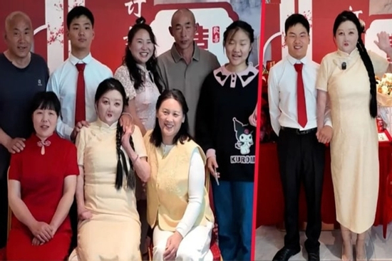 Cô gái bị bỏng 95% cơ thể lấy chàng trai sinh cùng ngày, tháng, năm