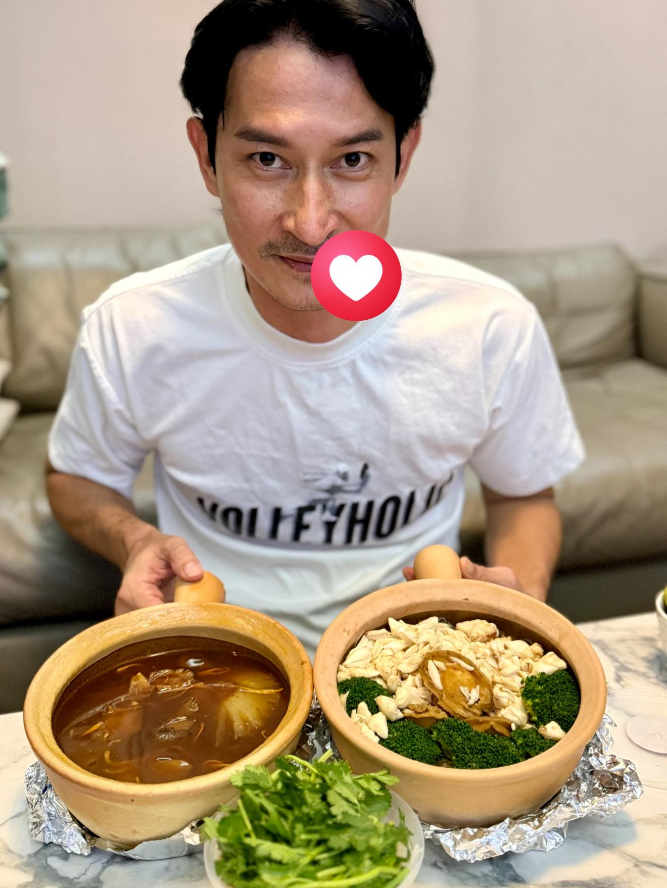 Huy Khánh tiết lộ tình trạng hiện tại sau khi môi sưng phù biến dạng