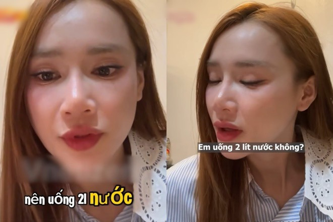 Nhã Phương gầy rộc lộ hàng loạt dấu hiệu lão hóa qua camera thường