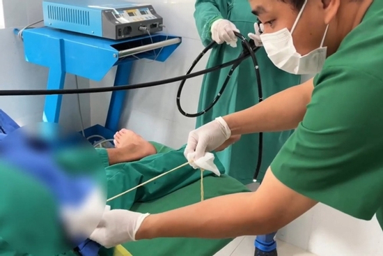 Sán dài 1m 'cư ngụ' trong cơ thể nam thanh niên vì món ăn này