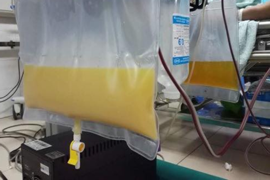 'Thánh nhậu' trách bác sĩ 'chú cứ dọa anh' để rồi phải cấp cứu viêm tụy cấp