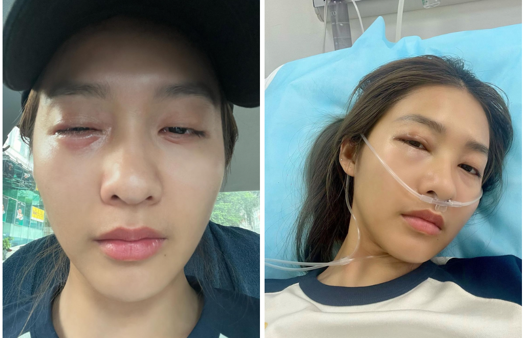 Cam thường bắt trọn sắc vóc Khả Ngân sau thời gian gầy gò liên tục nhập viện