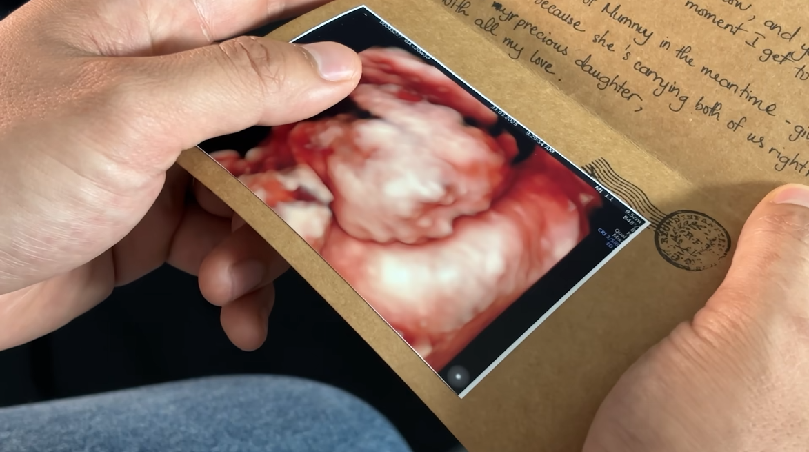 Lộ giới tính con Ngô Thanh Vân