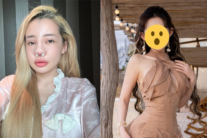 Ngân 98 chuẩn bị 'đập mặt xây lại' lần thứ 12, ngoại hình hiện tại gây sốc