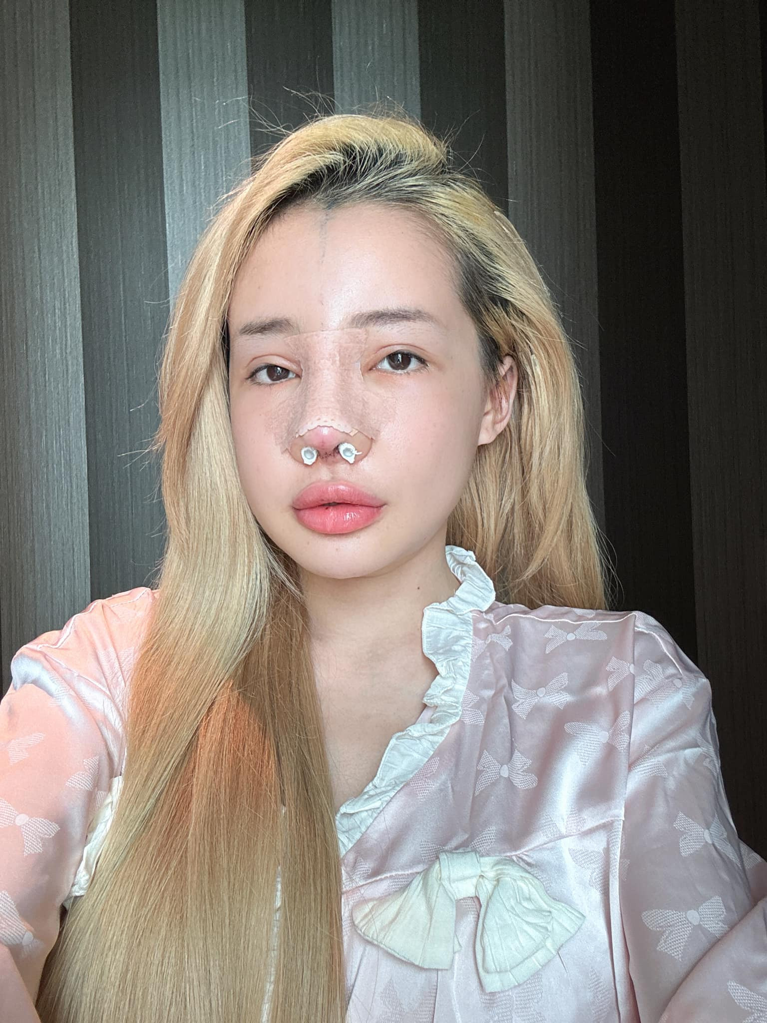 Ngân 98 chuẩn bị đập mặt xây lại lần thứ 12 ngoại hình hiện tại gây sốc