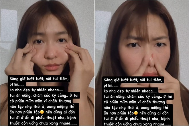 Bị nghi 'ở ẩn' phẫu thuật thẩm mỹ, Khả Ngân có hành động khiến netizen câm nín Bị nghi ở ẩn phẫu thuật thẩm mỹ Khả Ngân có hành động khiến netizen câm nín