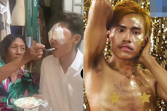 Lai Thai - thí sinh hot nhất Nam vương Campuchia tiếp tục thẩm mỹ mắt gây sốc
