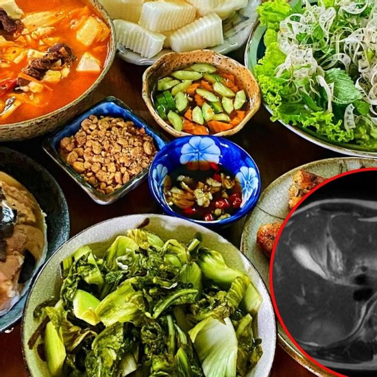 Người phụ nữ Hà Nội bất ngờ phát hiện tổn thương gan: Bác sĩ chỉ đích danh 2 thủ phạm