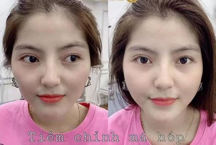 Diện mạo đơ cứng của Chu Thanh Huyền sau nghi vấn thẩm mỹ nhìn mãi mới nhận ra