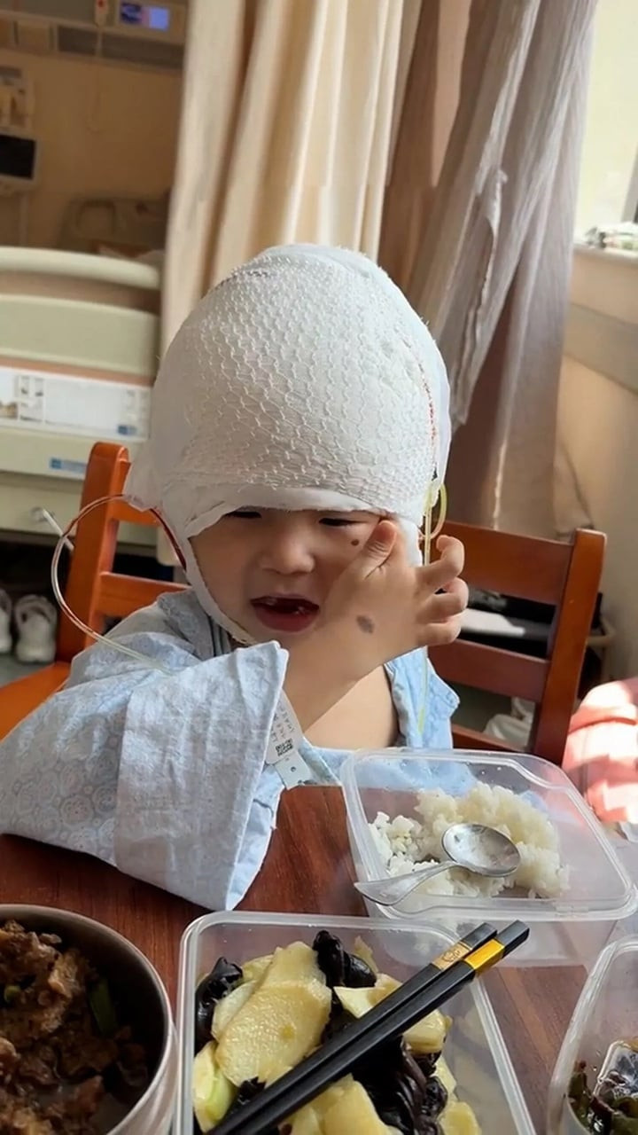 Cậu bé đã được phẫu thuật. (Ảnh: NX)