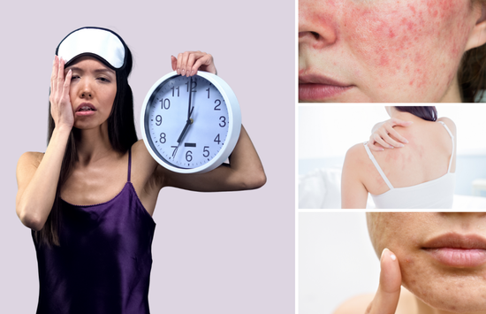 Giấc ngủ đủ (ngủ đủ giấc) giúp phục hồi và tái tạo da như thế nào?