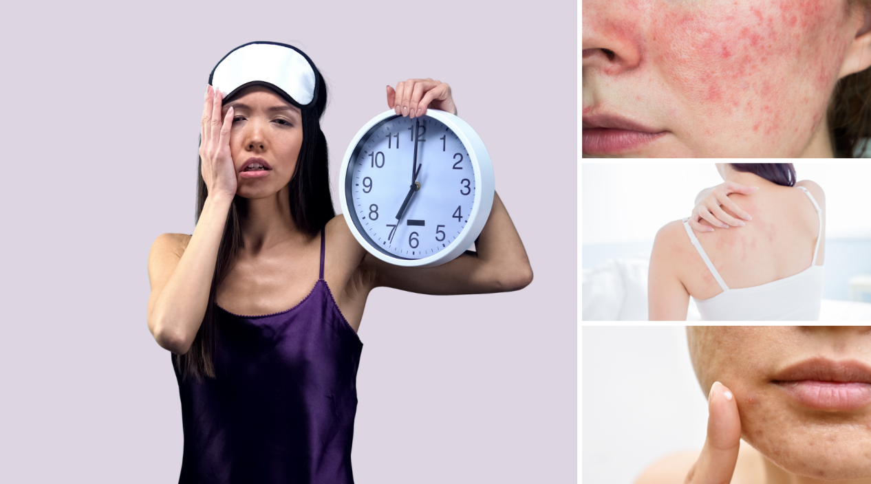 Ngủ đủ giấc giúp phục hồi và tái tạo da như thế nào?- Ảnh 2.