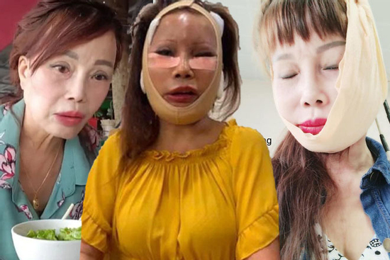 Sốc diện mạo hiện tại của 'cô dâu Cao Bằng' Thu Sao sau 6 năm thẩm mỹ