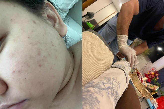 Tình trạng hiện tại của Trúc Anh Mắt Biếc sau khi tăng 30kg sức khỏe suy kiệt trầm trọng