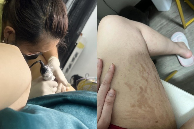 Tình trạng hiện tại của Trúc Anh Mắt Biếc sau khi tăng 30kg sức khỏe suy kiệt trầm trọng