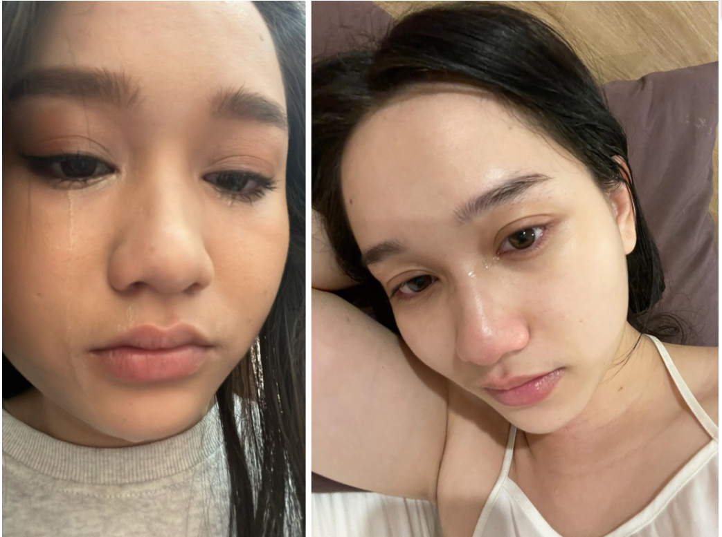 Tình trạng hiện tại của Trúc Anh Mắt Biếc sau khi tăng 30kg sức khỏe suy kiệt trầm trọng