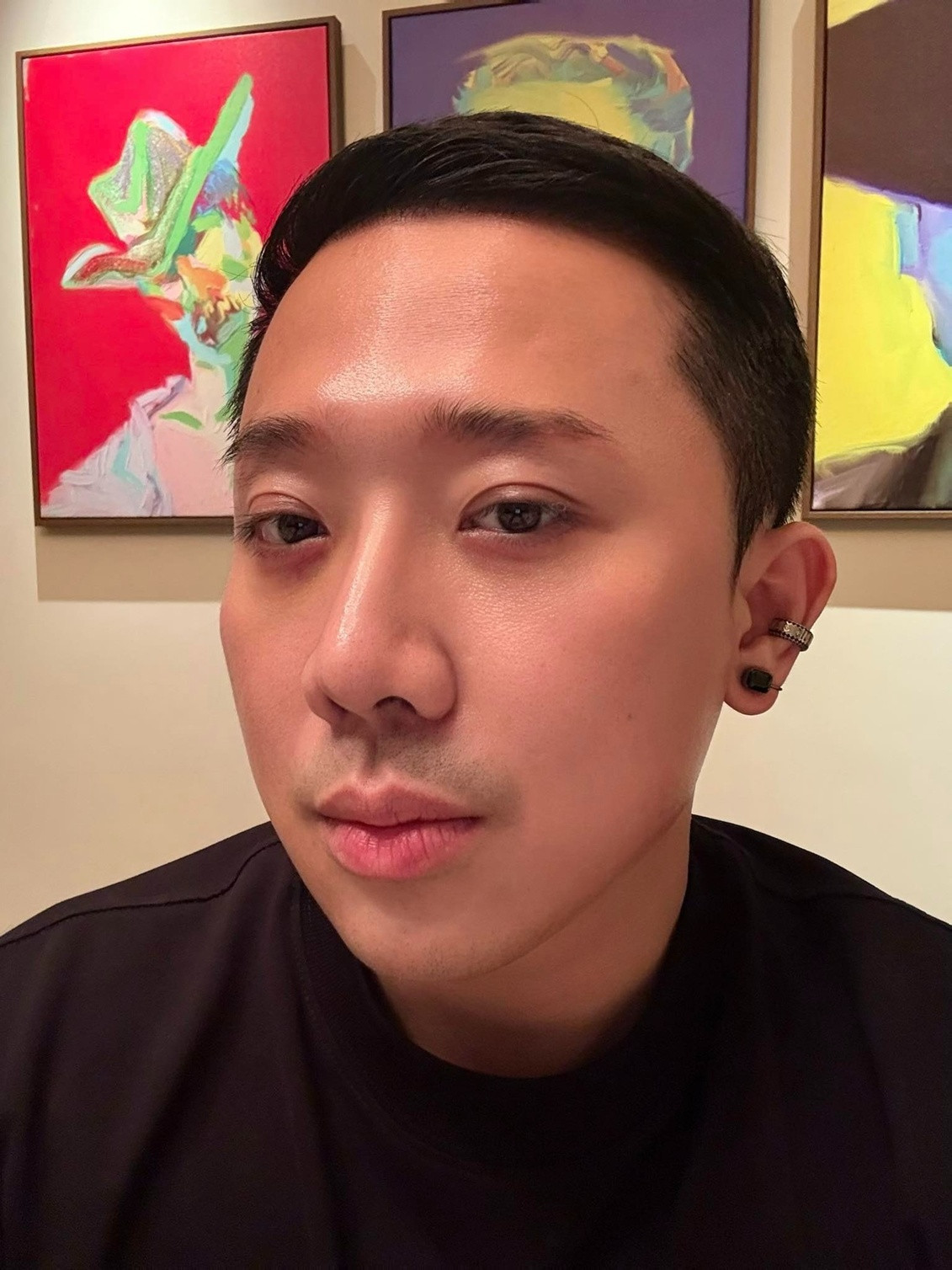 Trấn Thành đăng ảnh cằm nhọt hoắt nghi photoshop quá đà