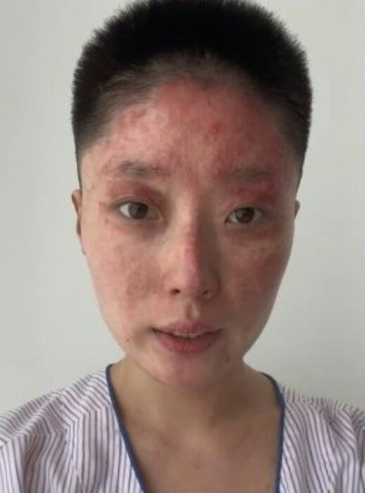 Nữ người mẫu bị bỏng nặng sau vụ nổ khí gas ảnh 3