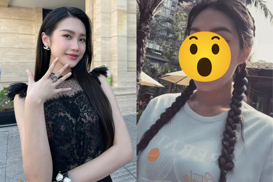 Doãn Hải My lộ gương mặt lạ hoắc nghi thẩm mỹ, giật mình nhận chẳng ra