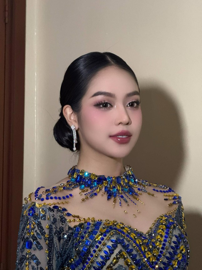 Hoa hậu Thanh Thủy nhập viện ở Indonesia ảnh 1