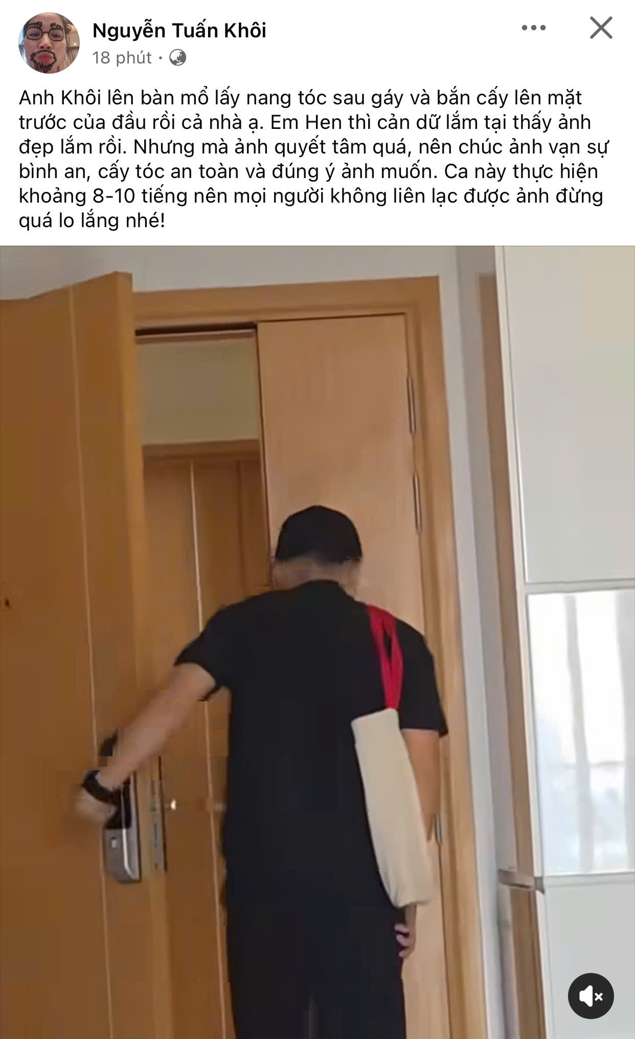 Lộ ảnh chồng HHen Niê đi cấy tóc ở bệnh viện sau màn công khai đầu hói gây sốc