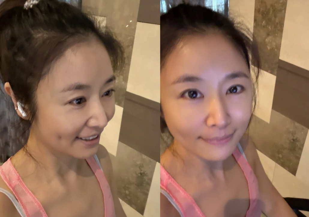 Mặt mộc của Lâm Tâm Như bị nghi di chứng phẫu thuật thẩm mỹ hỏng? - Ảnh 1