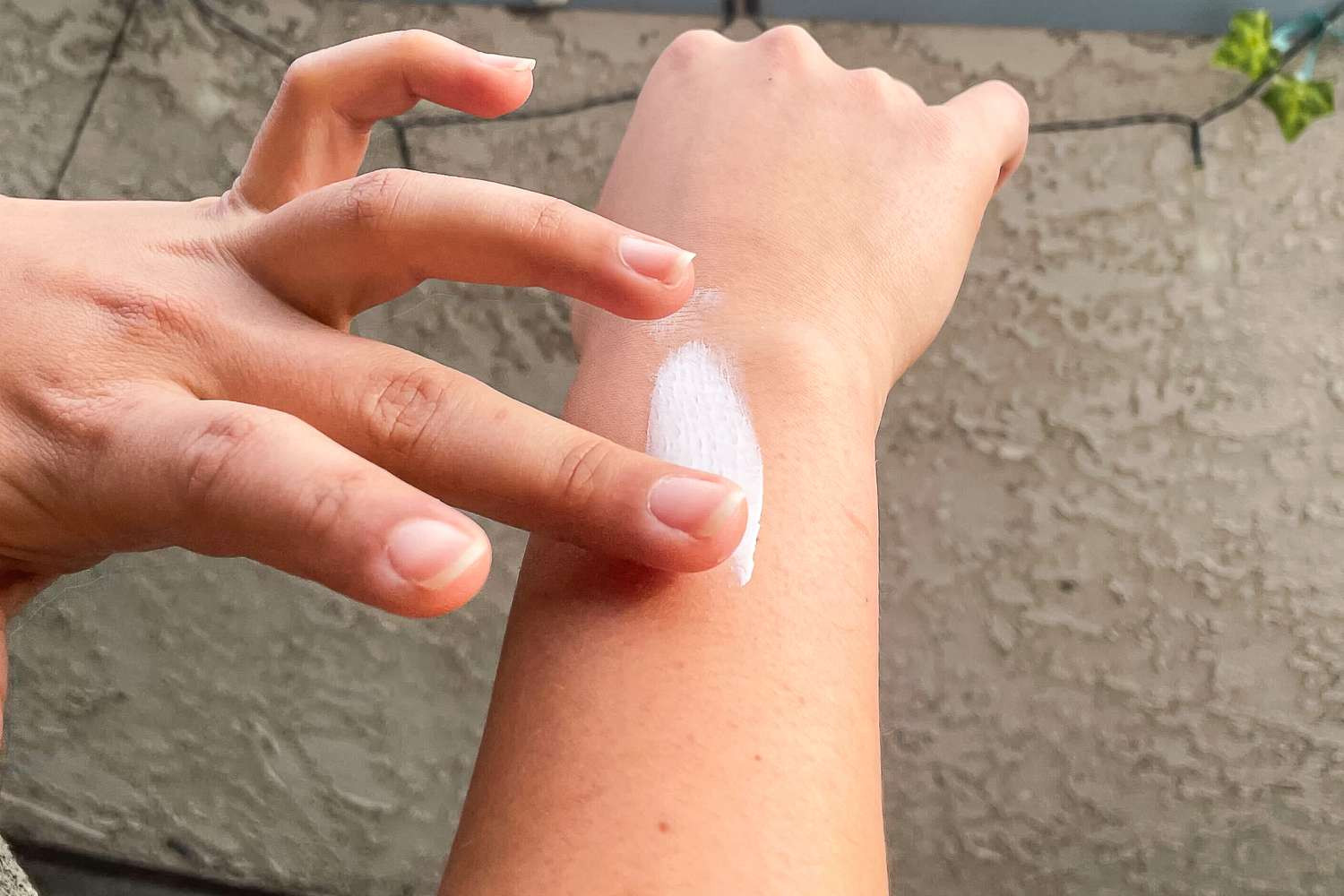 Cách xử trí khi bị dị ứng kem chống nắng- Ảnh 2.