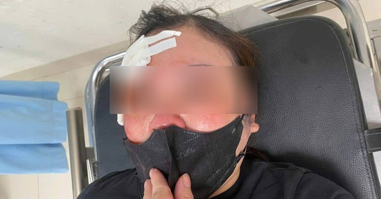 Nữ tài xế ở Hà Nội 'tố' bị người đi ô tô dùng dùi cui vụt vào đầu