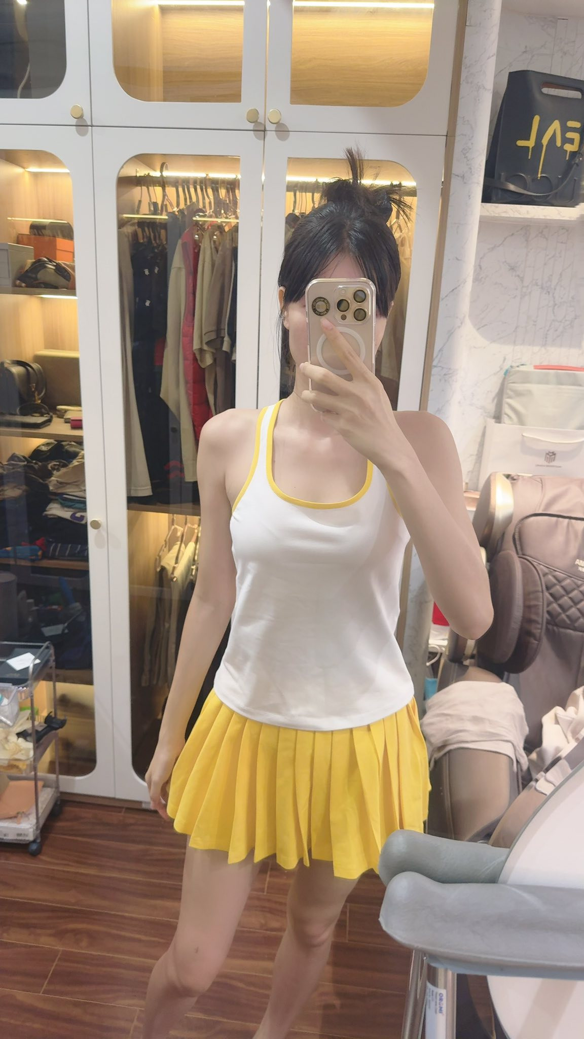 Kỳ Hân lộ đôi chân đầy con rết sau chấn thương gãy đùi trên sân pickleball