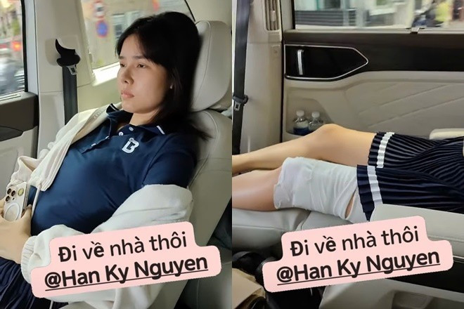 Kỳ Hân lộ đôi chân đầy con rết sau chấn thương gãy đùi trên sân pickleball