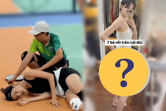 Kỳ Hân lộ đôi chân đầy 'con rết' sau chấn thương gãy đùi trên sân pickleball