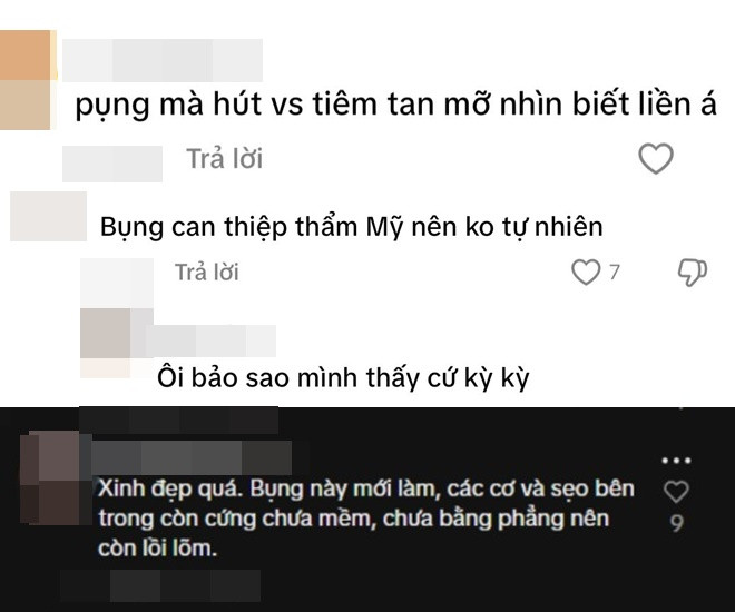 Huyền Baby mới phẫu thuật vòng 2 để có cơ bụng múi nào ra múi nấy lộ liễu