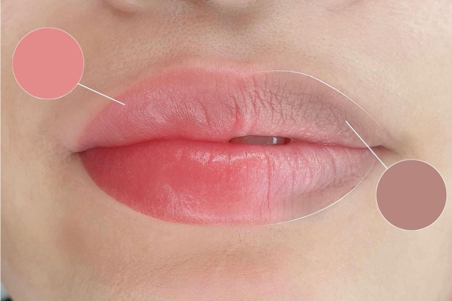 Nguyên nhân khiến môi thâm và cách khắc phục hiệu quả- Ảnh 2.