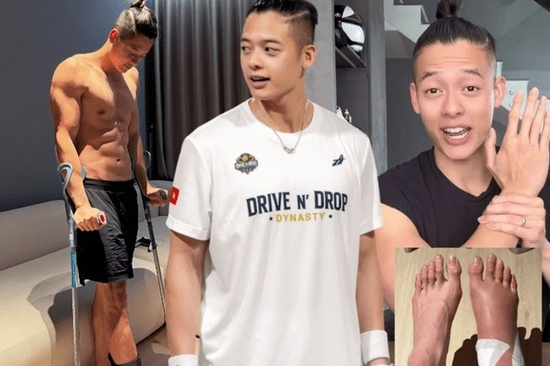 Từ vụ TikToker gãy xương sau 4 tiếng chơi pickleball, chuyên gia kêu gọi: 'Đừng để đam mê thành rủi ro'