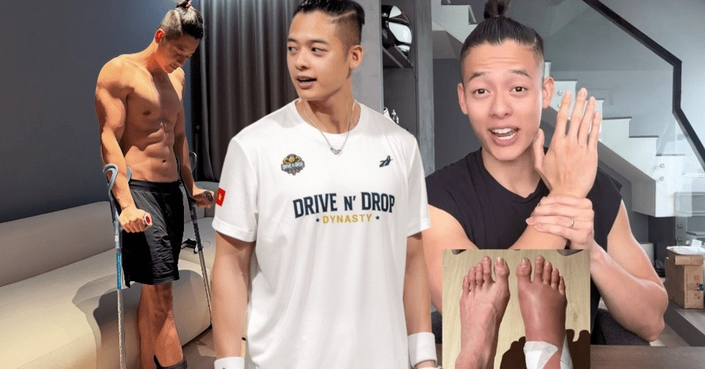 sau ky han mot tay choi quen mat gay xuong mac khi danh pickleball 4 tieng 912