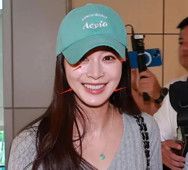 Kim Tae Hee nói về gương mặt cứng đờ nhan sắc xuống cấp